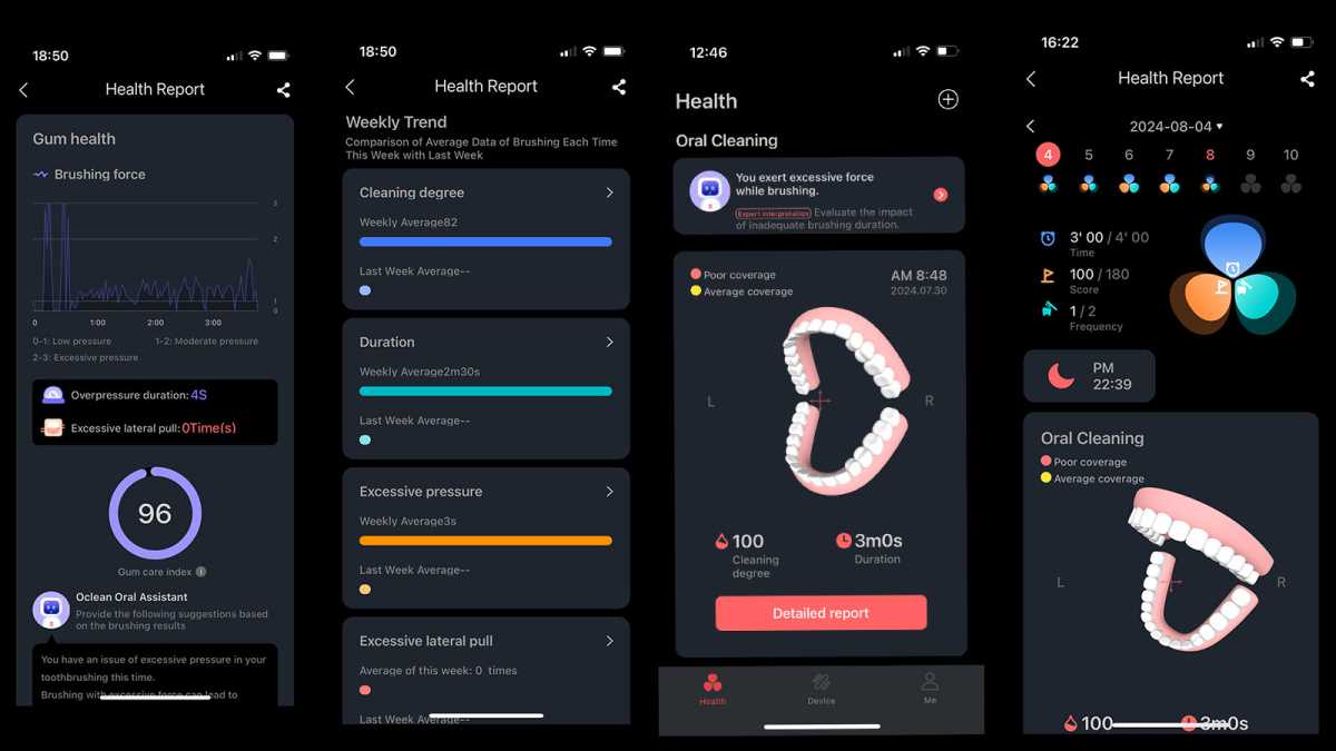 Capturas de pantalla de la aplicación Oclean que muestran informes de cepillado 